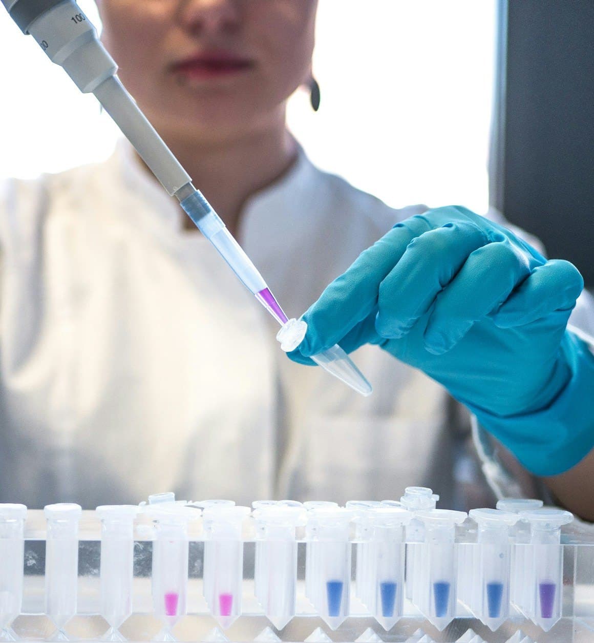 A lab technician in teal gloves pipettes diagnostic samples: where the 105,000 records begin
